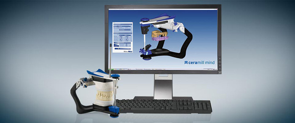 Ceramill Artex