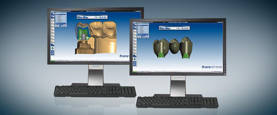 Ceramill M-Plant