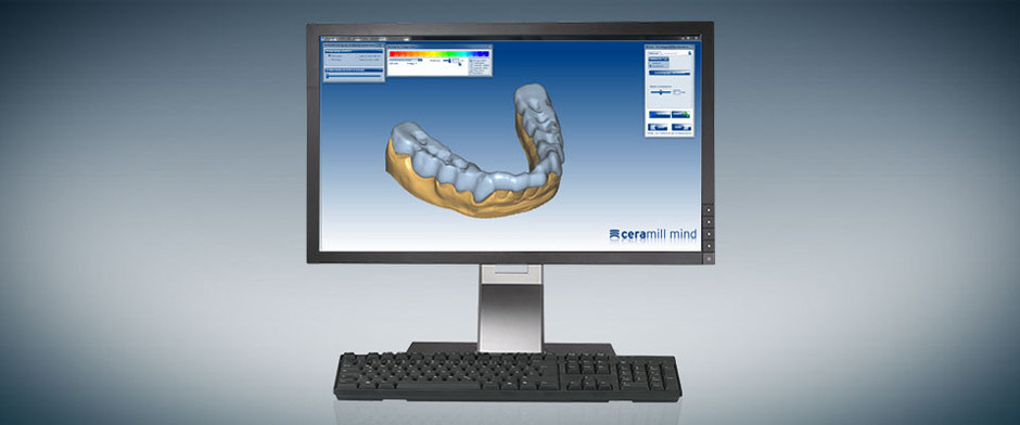 Ceramill M-Splint