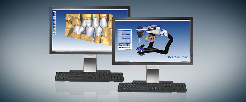 Ceramill Mind