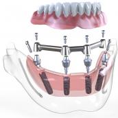 MultiPlus
